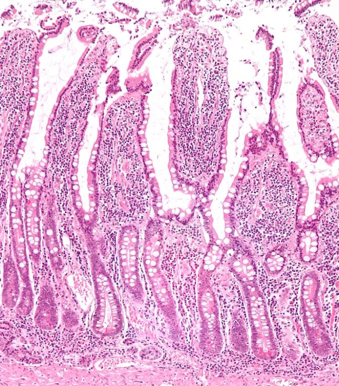 Human Digestive System Food Resorption In The Small Intestine