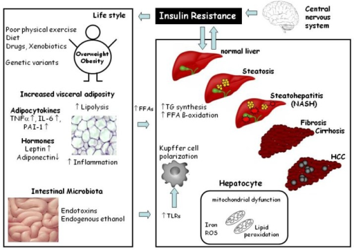 Fat Absorption and MTP Inhibitors: Orlistat and Lomitapide