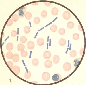 parasites in blood
