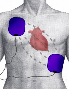 position of pads position of pads