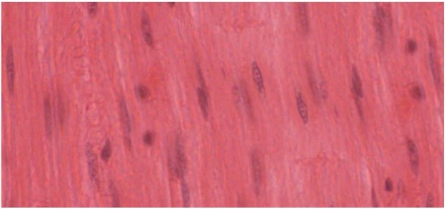 Connective Tissue, Muscle Tissue, Epithelial Tissue, & Nervous Tissue