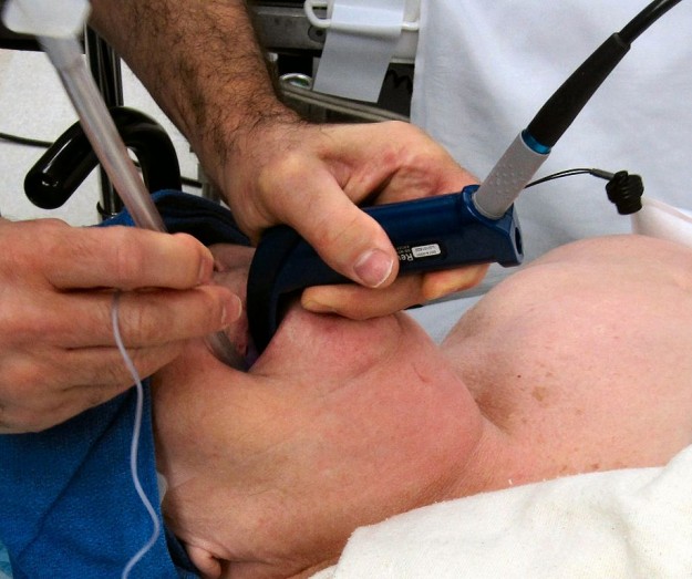Anesthesiologist using Glidescope video laryngoscope to intubate the trachea of a morbidly obese patient with challenging airway anatomy Anesthesiologist using Glidescope video laryngoscope to intubate the trachea of a morbidly obese patient with challenging airway anatomy