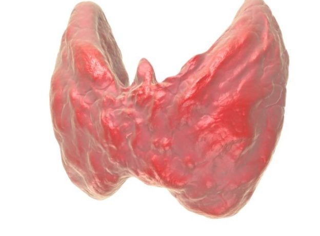 Thyroid disease (frontal)