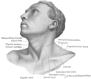 The muscles involved with torticollis The muscles involved with torticollis